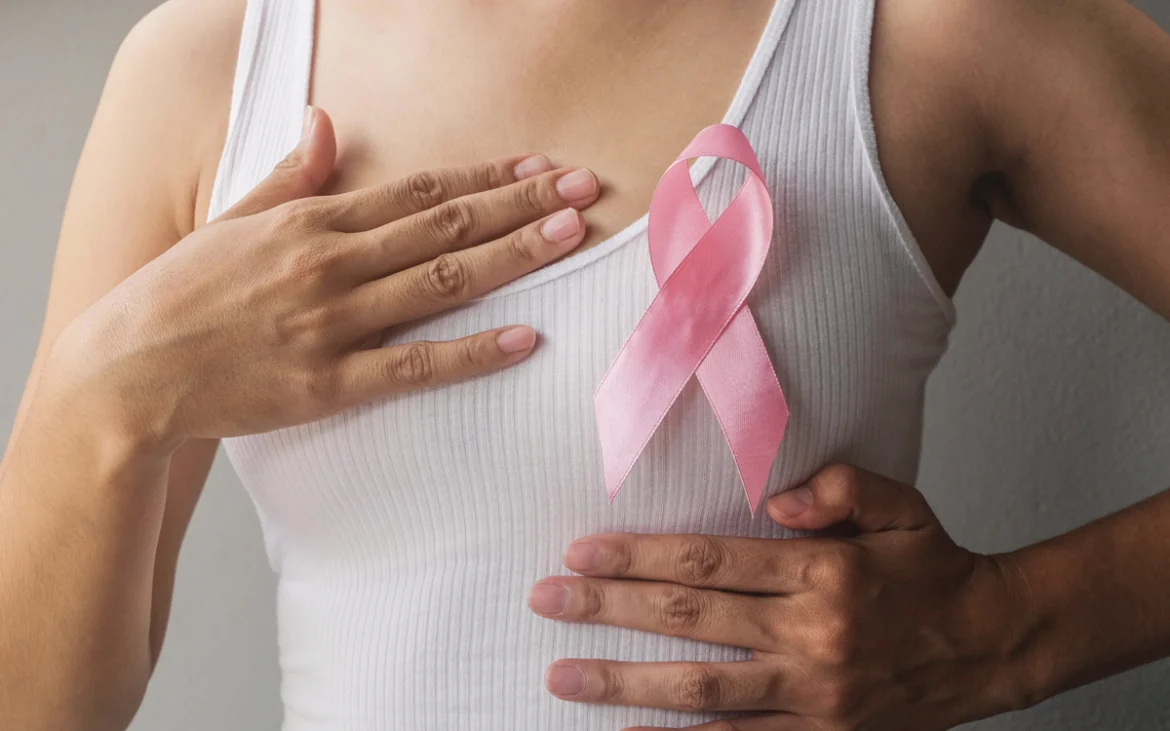 myStage Dx: evaluación del riesgo de recurrencia del cáncer de mama